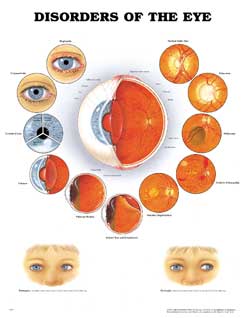 Расстройства глаза
