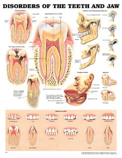 Заболевания зубов и челюстей